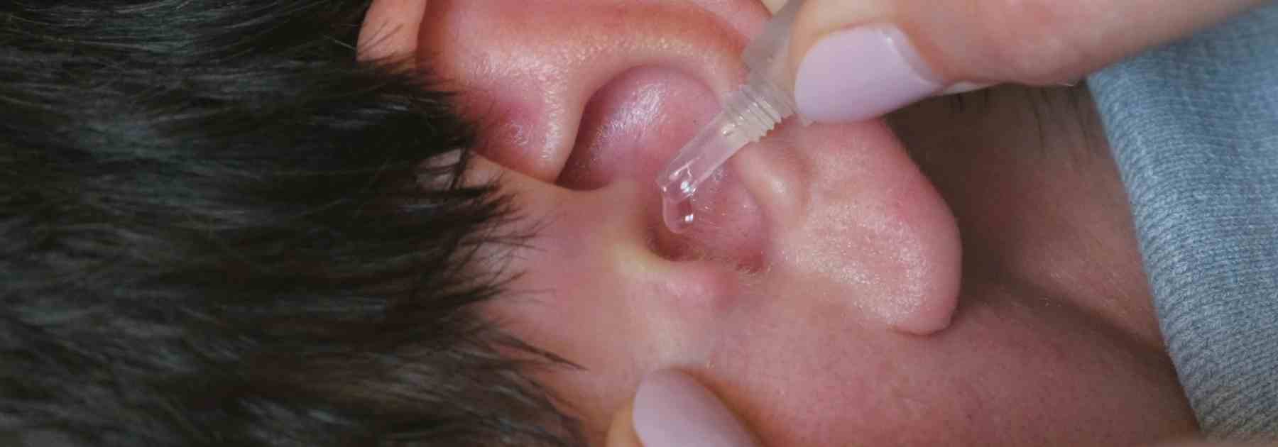 Best earwax removal in London