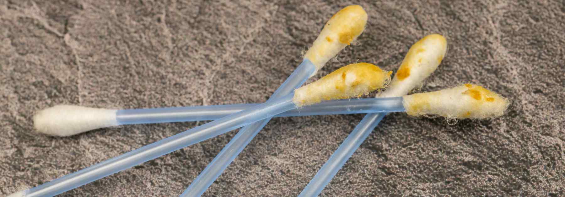 Earwax covered cotton buds