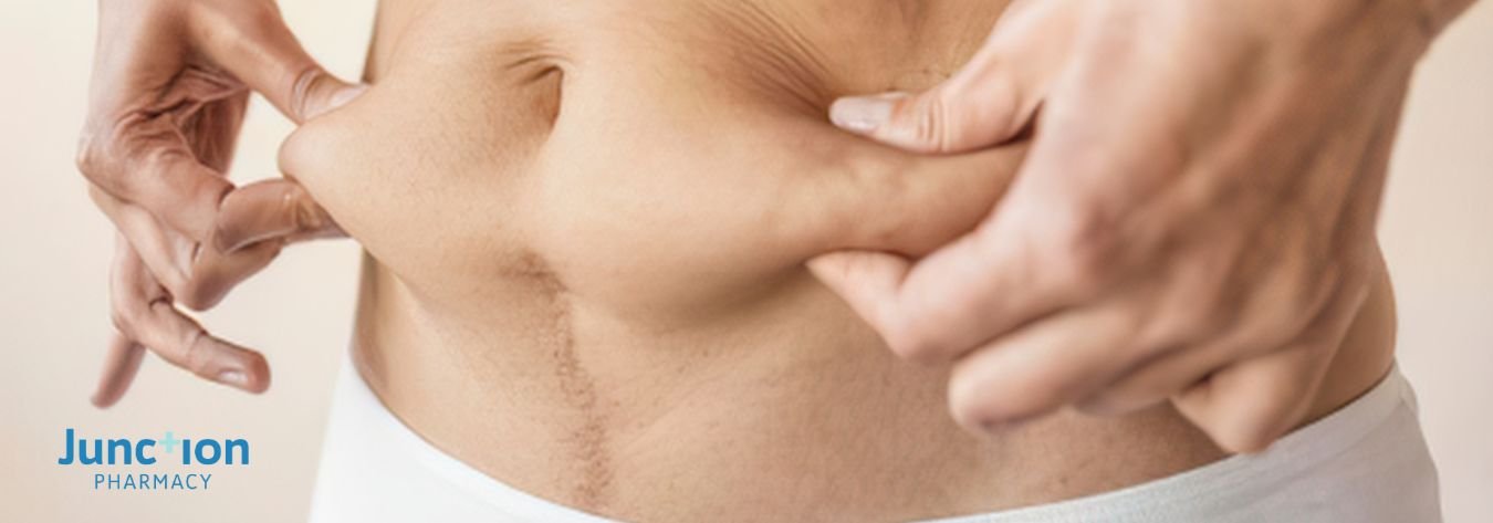 Loose skin after weight loss